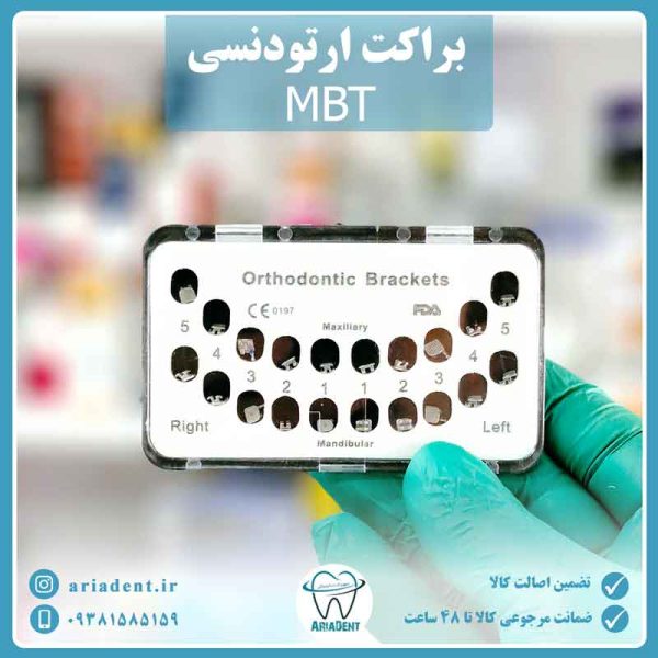 براکت ارتودنسی MBT